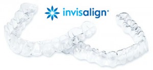 invisalign