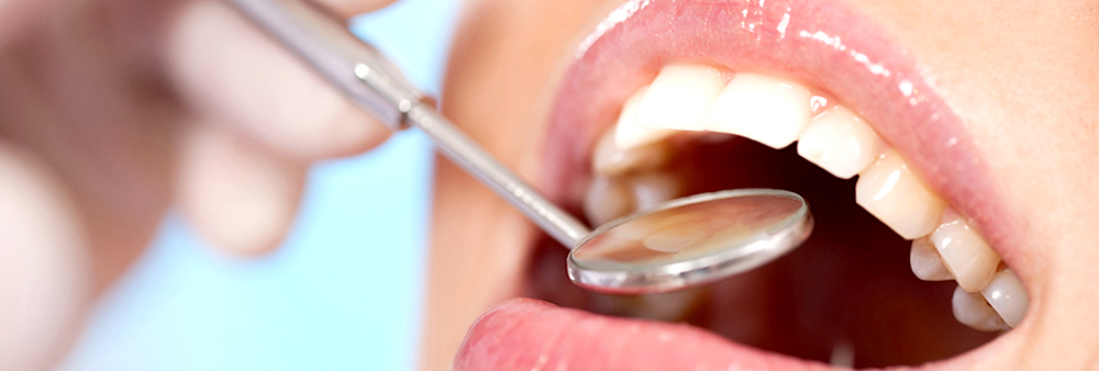 カンファークリニックの歯のメインテナンス